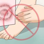 Preventing Fungal Infections in Bangladesh’s Climate