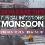 Tinea During Monsoon Season