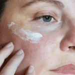 Azelaic acid