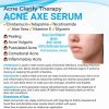 Acne Axe Serum for Acne Treatment with Adorabella Logo – Fights Acne Vulgaris, Comedonal & Inflammatory Acne