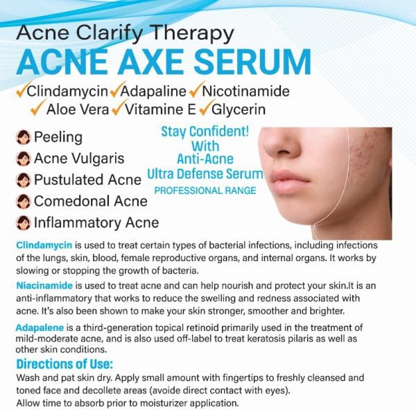 Acne Axe Serum for Acne Treatment with Adorabella Logo – Fights Acne Vulgaris, Comedonal & Inflammatory Acne