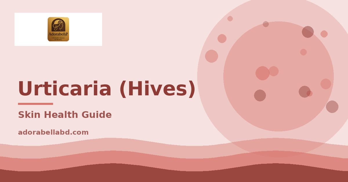 আমবাত (Urticaria): কারণ, লক্ষণ ও কখন জরুরি চিকিৎসা লাগে